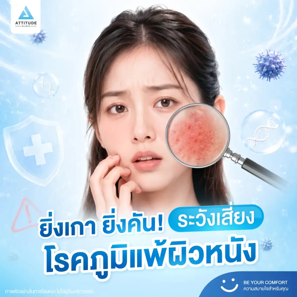 ต้องระวัง! อาการยิ่งเกายิ่งคัน อาจเป็นสัญญาณบอก ‘โรคภูมิแพ้ผิวหนัง’