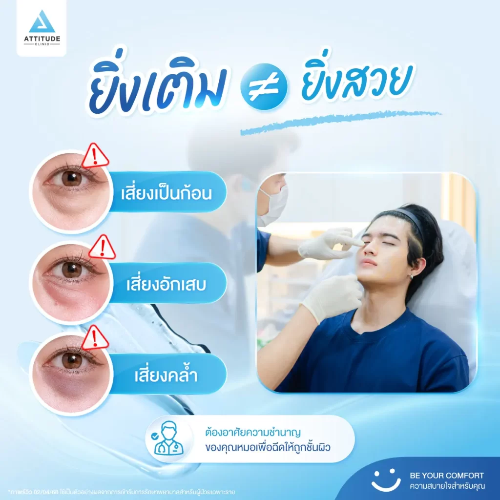 ไม่อยากใต้ตาพัง ก่อนจะเติมโปรแกรมฟิลเลอร์ ต้องรู้สิ่งนี้!