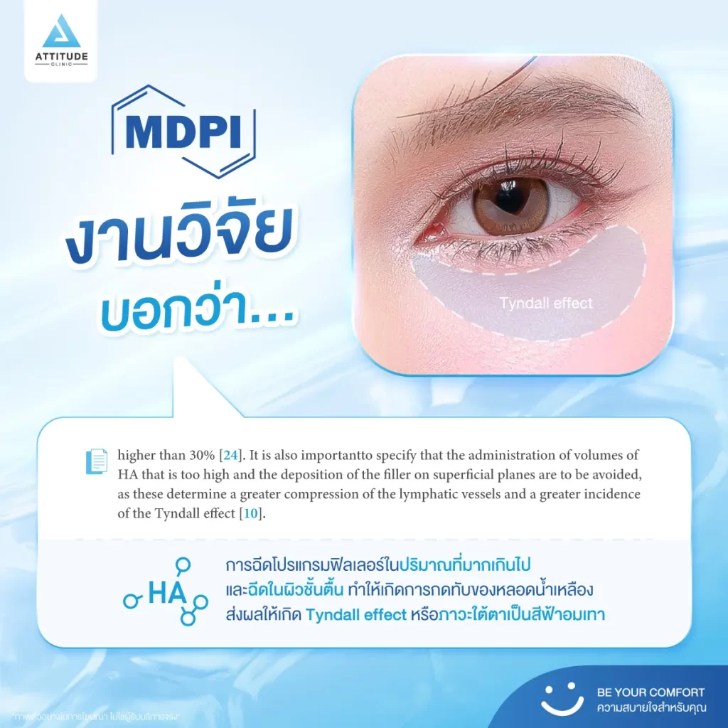 ไม่อยากใต้ตาพัง ก่อนจะเติมโปรแกรมฟิลเลอร์ ต้องรู้สิ่งนี้!