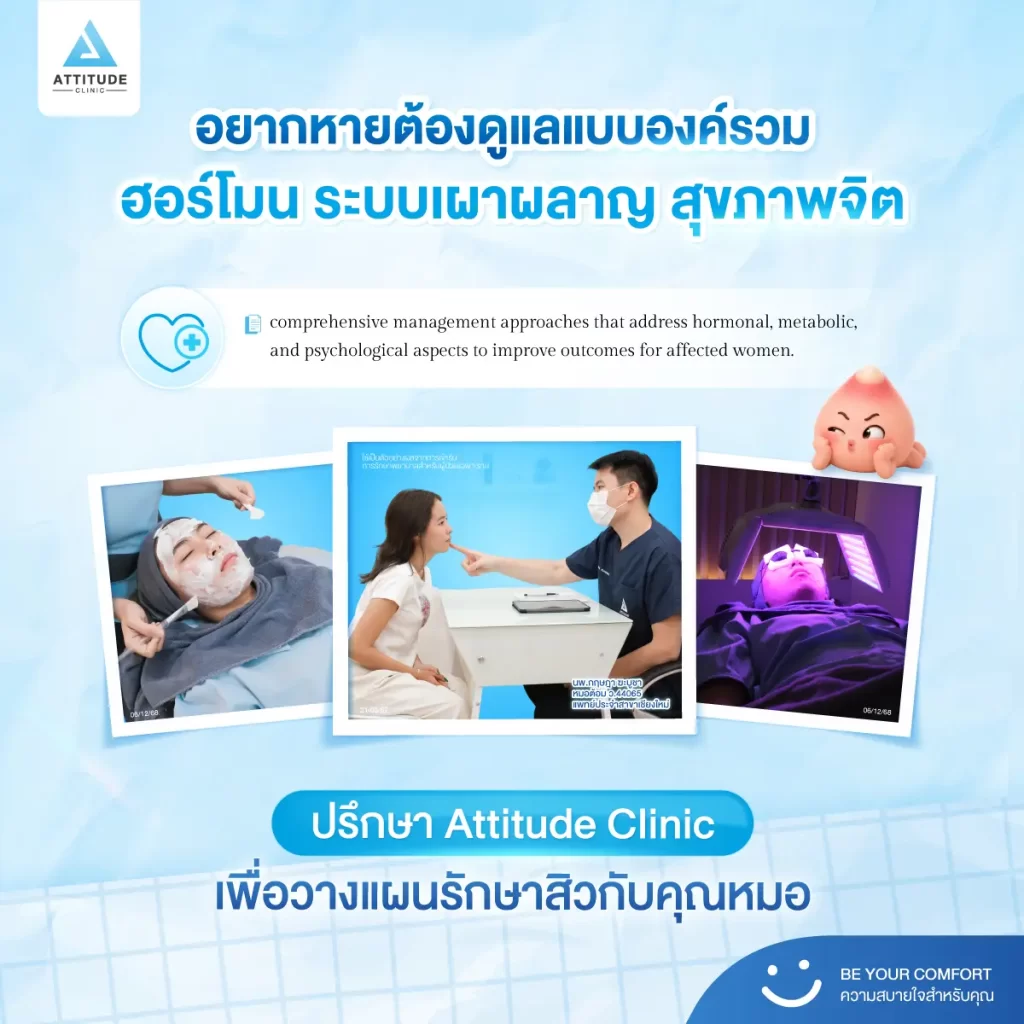 สาวๆ ต้องระวัง! สิวเรื้อรัง เป็นๆ หายๆ สัญญาณเตือนภาวะฮอร์โมนผิดปกติ