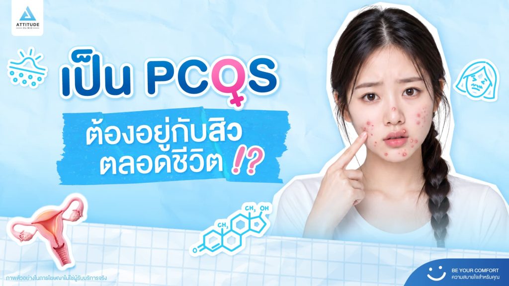 สาวๆ ต้องระวัง! สิวเรื้อรัง เป็นๆ หายๆ สัญญาณเตือนภาวะฮอร์โมนผิดปกติ