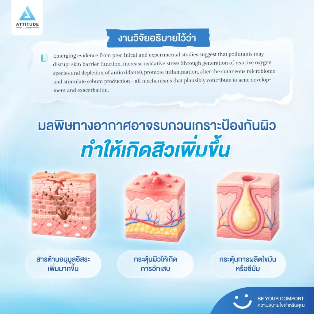 ไม่ได้กระทบแค่ปอด! อากาศแย่อาจกระตุ้นสิวได้มากกว่าที่คิด