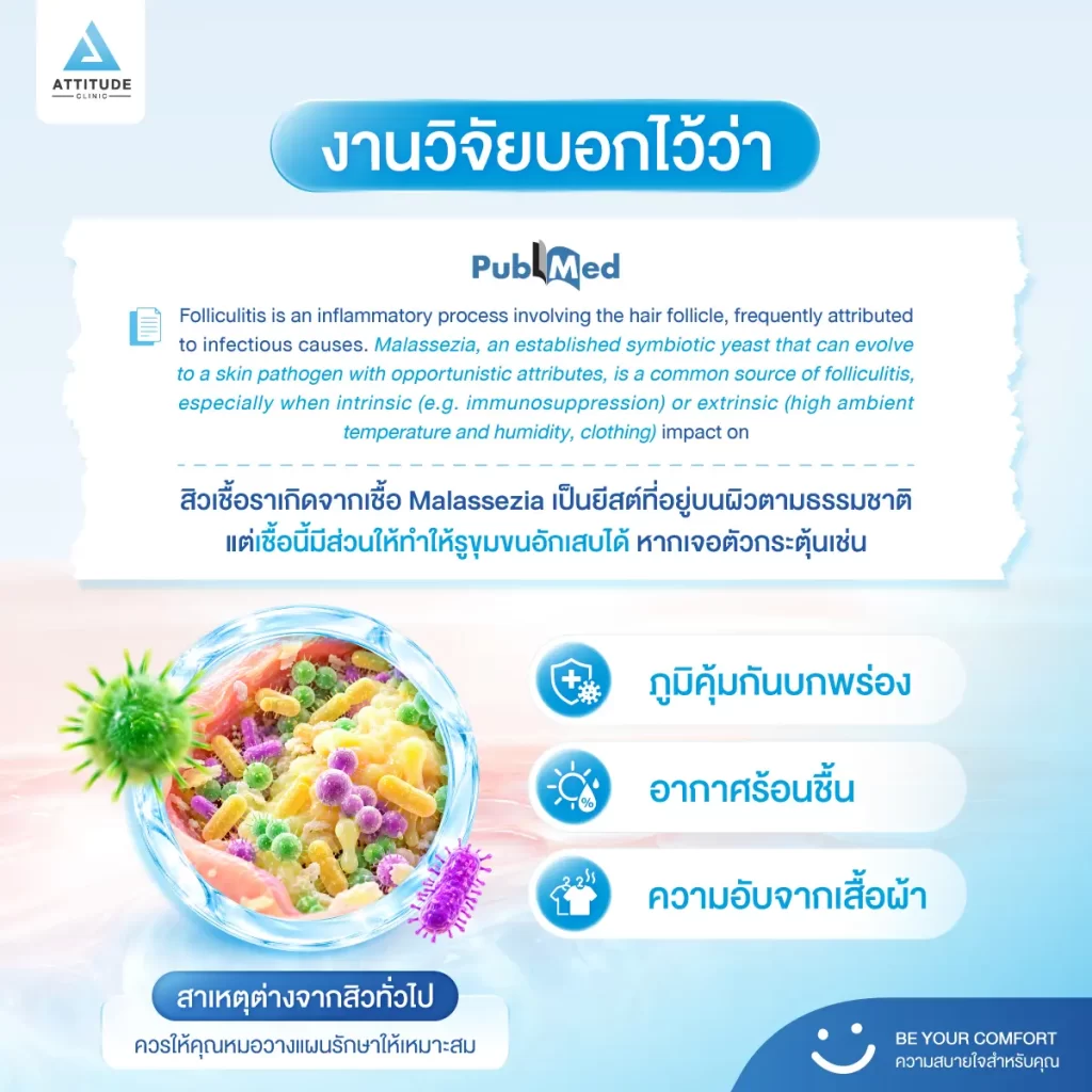 สิวกระจุกอยู่ที่เดียว ต้องระวัง! สิวแบบนี้ ไม่ใช่สิวธรรมดาทั่วไป