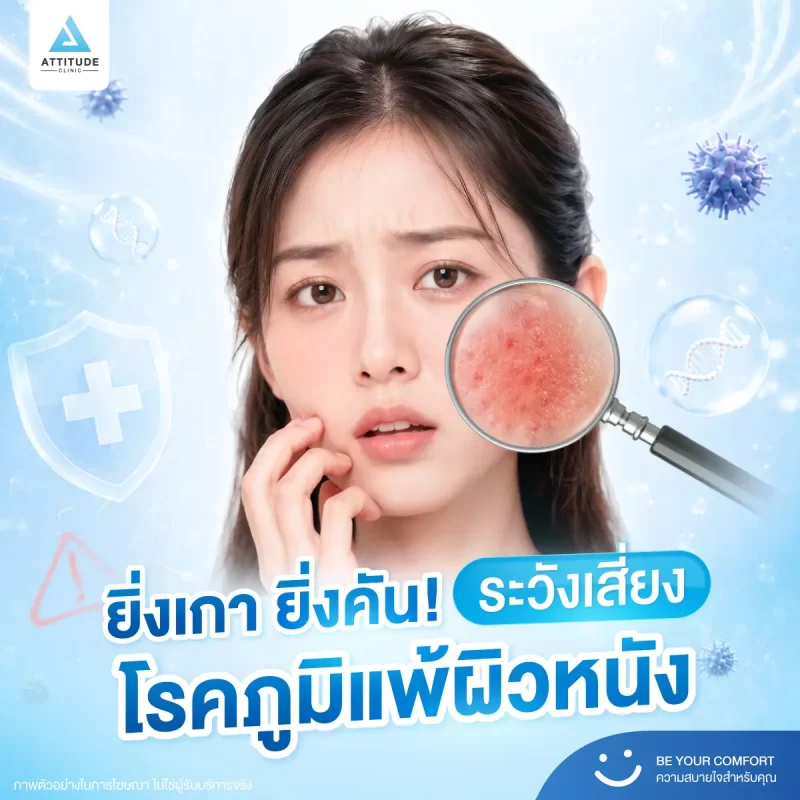ต้องระวัง! อาการยิ่งเกายิ่งคัน อาจเป็นสัญญาณบอก ‘โรคภูมิแพ้ผิวหนัง’