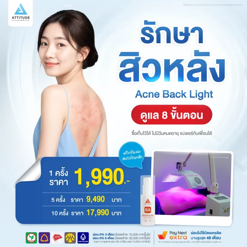 15-โปรโมชั่น-Acne-Back-Light-รักษาสิวหลัง-1200x1200-New