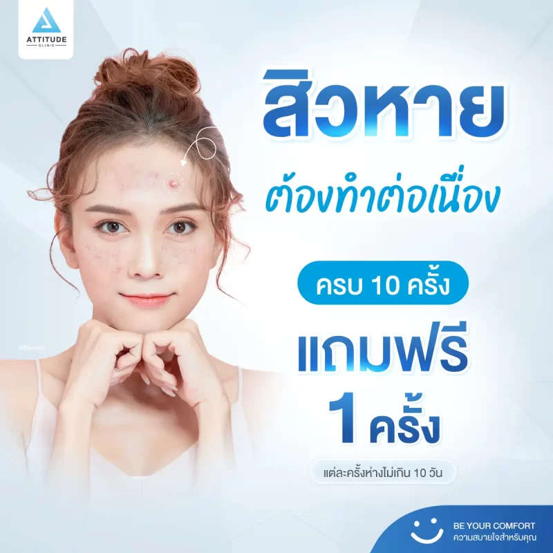 16-Content-สิวจะหาย-ต้องทำต่อเนื่อง-ครบ-10-ครั้ง-แถมฟรี-1-ครั้งทันที-1200x1200