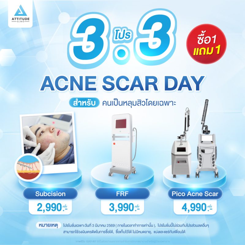 24-โปรโมชั่น-3.3-หลุมสิวเดย์-1040x1040