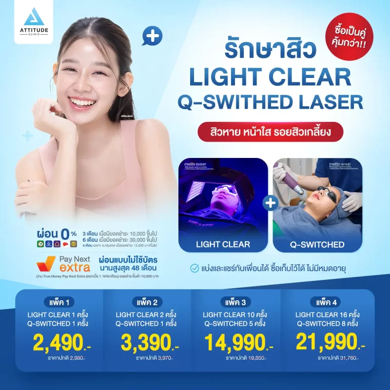 27_promotion_โปรรักษาสิว + เลเซอร์ Q-Switched (1)