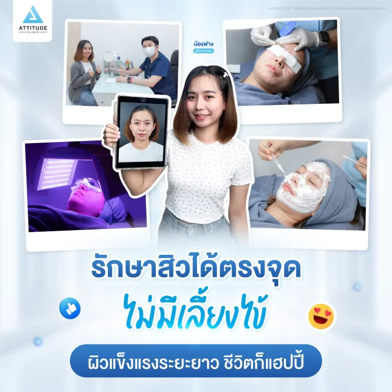 รักษาสิวขอนแก่น ATTITUDE CLINIC รักษาสิวอักเสบ รักษาสิวอุดตัน สิวหายไม่มีเลี้ยงไข้ ดูแลโดยคุณหมอที่มีประสบการณ์ทุกเคส อยู่ประจำคลินิกทุกวัน รักษาหายแล้วกว่า 20,000 คน