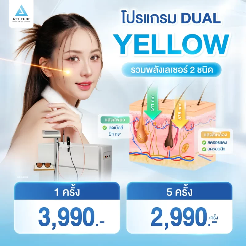 35_promotion_Dual-Yellow
