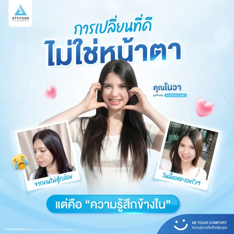สิ่งที่เปลี่ยนไป ไม่ใช่ใบหน้า… แต่คือความมั่นใจ