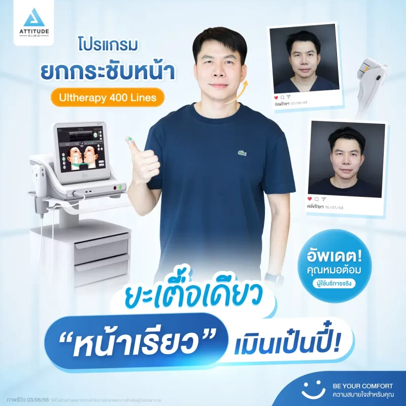 ยะเตื้อเดียว ‘หน้าเรียว’ เมินเป๋นปี๋! น้องกันเองพาส่องรีวิวโปรแกรม Ultherapy 400 Lines ของหมอต้อม ที่ Attitude Clinic กันครับ