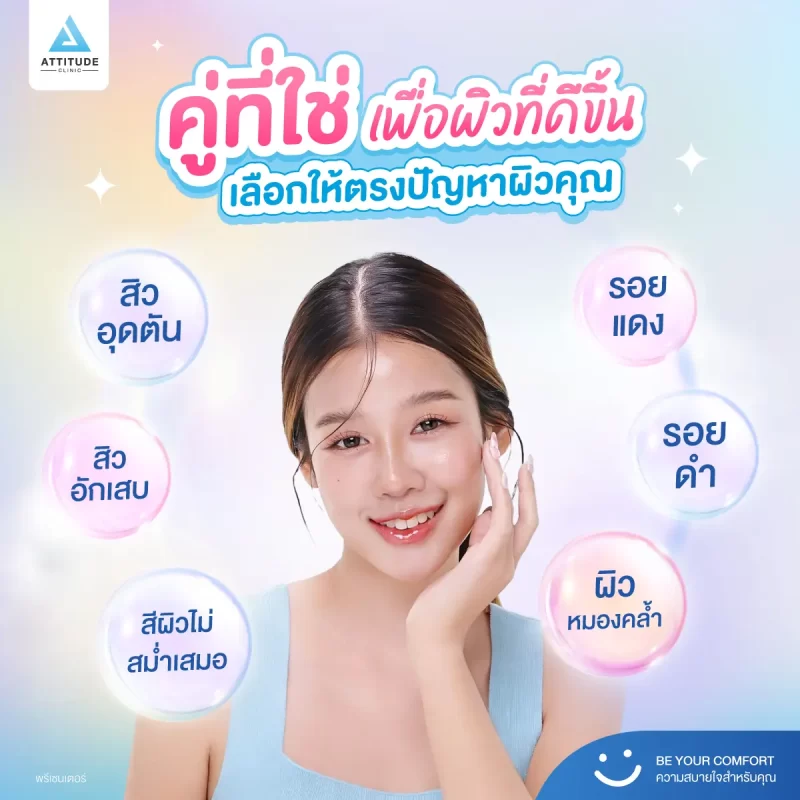 วาเลนไทน์นี้อยากหน้าเนียนใส สิวไม่กวนใจก่อนออกเดท มาหา “คู่ที่ใช่” รักษาสิว รอยสิวกัน