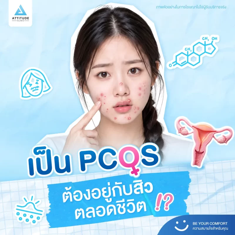 73_content_PCOS-ปก-1-1