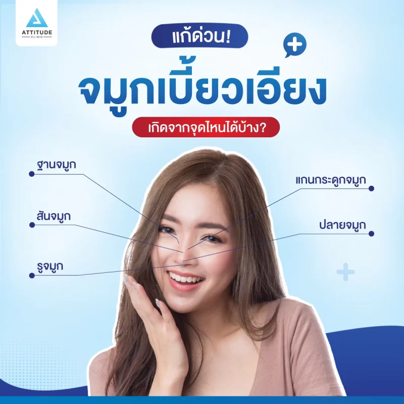 เสริมจมูก