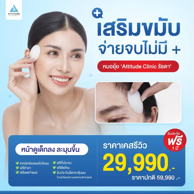 เสริมขมับ